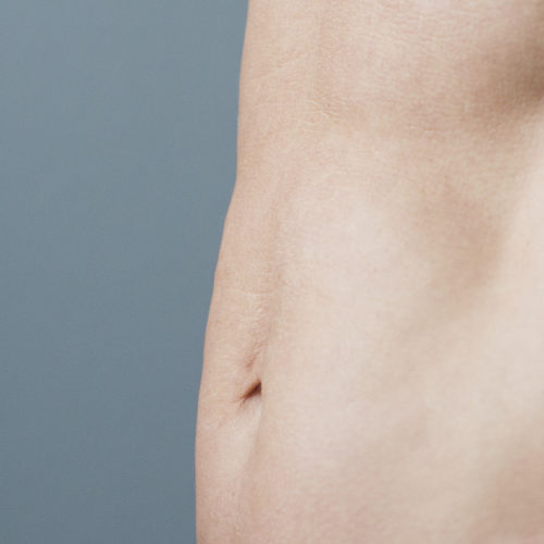 Mageplastikk, bukplastikk, delte magemuskler operasjon, gravid hos Klinikk Trondheim, plastisk kirurgi