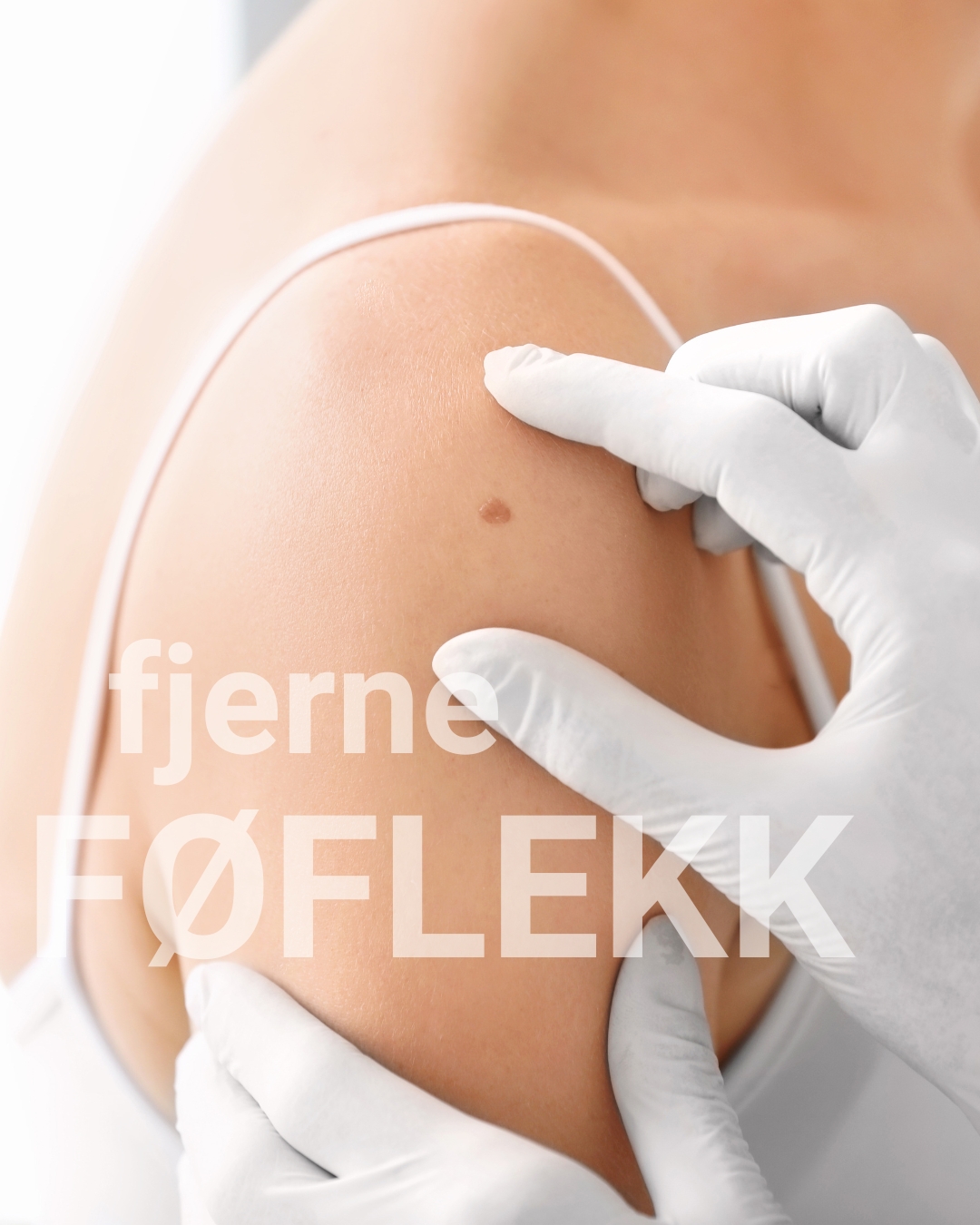 fjerne føflekk klinikk trondheim