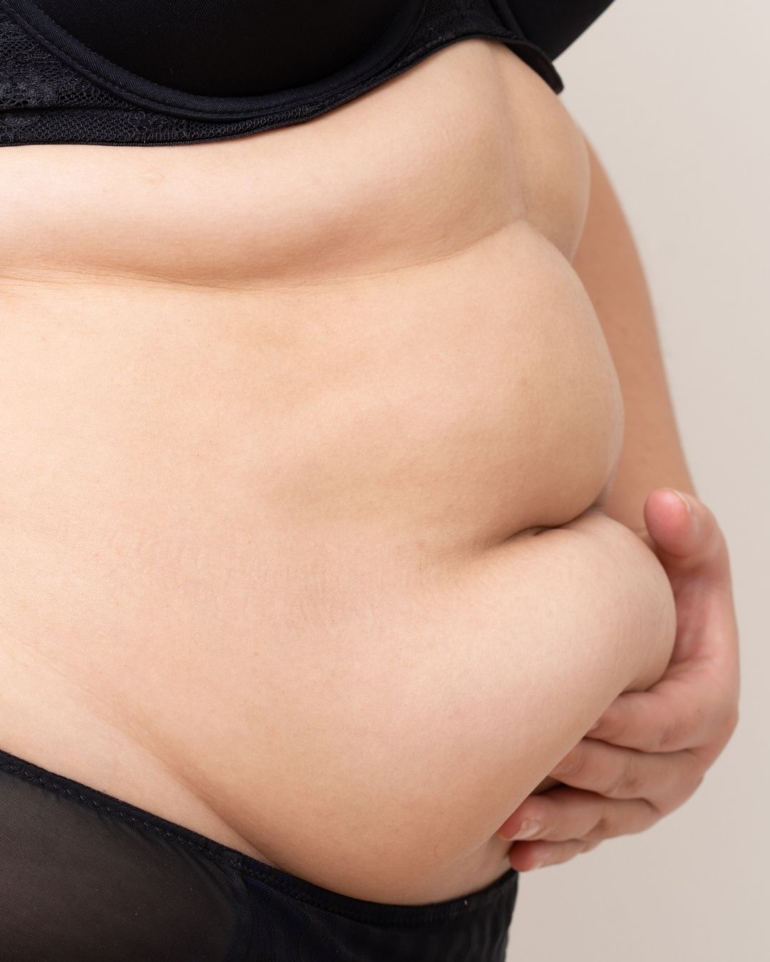 Bukplastikk–behandling-ved-hudoverskudd-på-magen