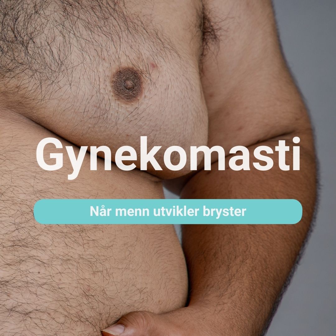 mannebryst-menn-utvikler-bryster-gynekomasti