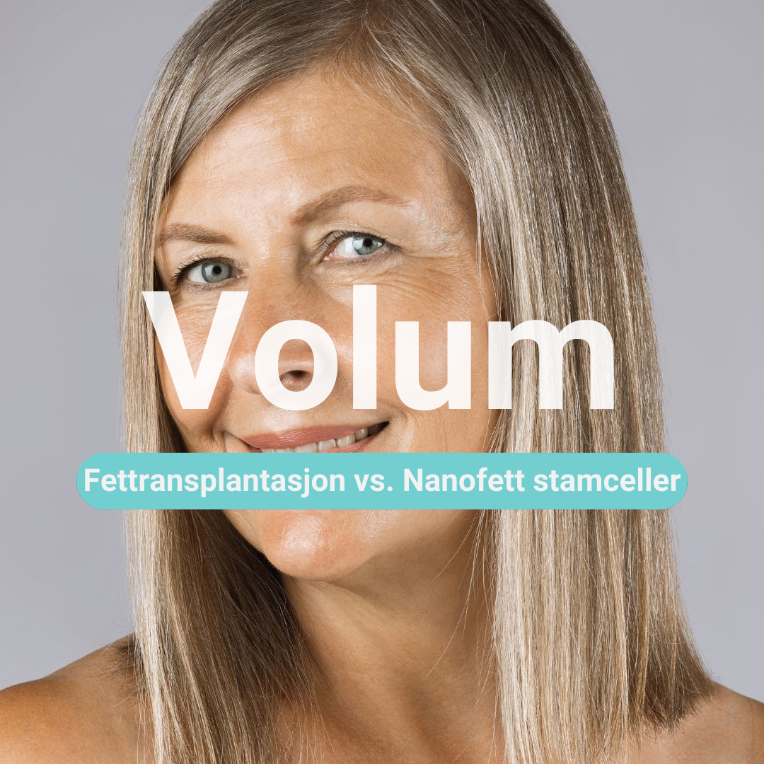 Fettransplantasjon vs.Nanofett