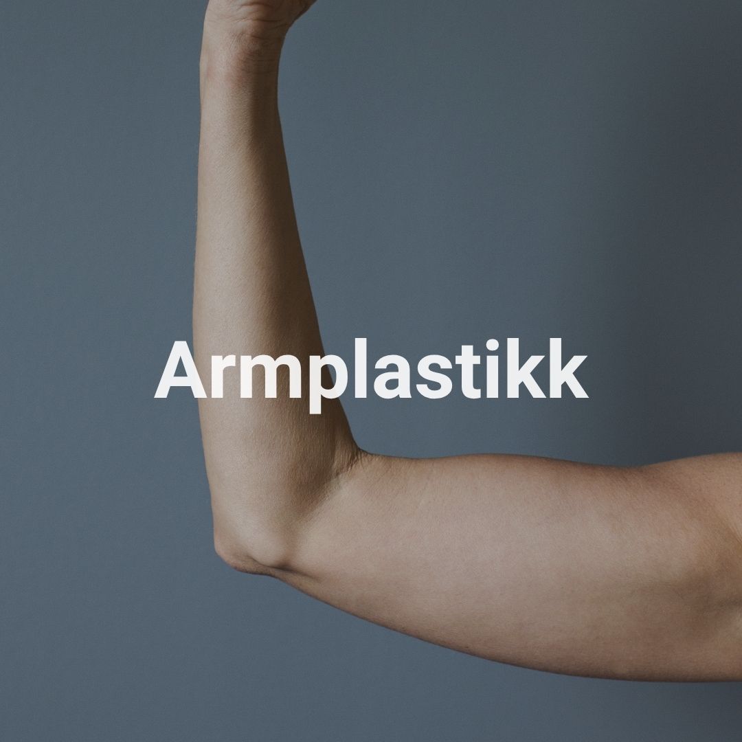 Armplastikk
