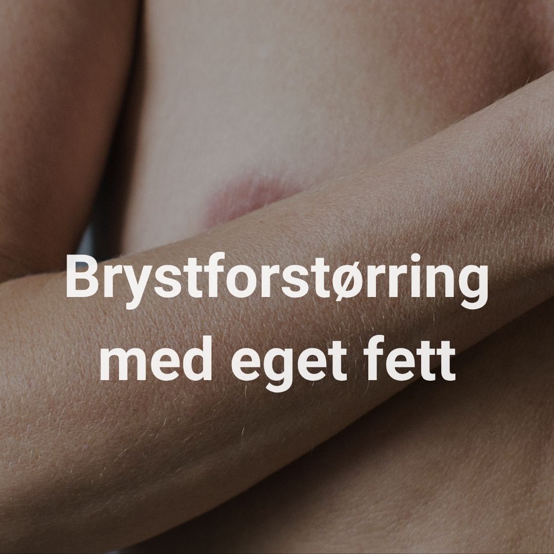 Brystforstørring med eget fett