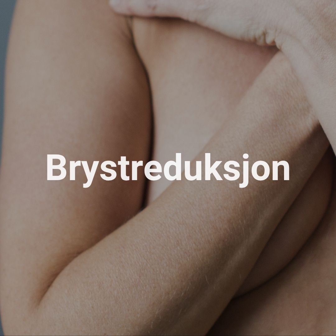 Brystreduksjon