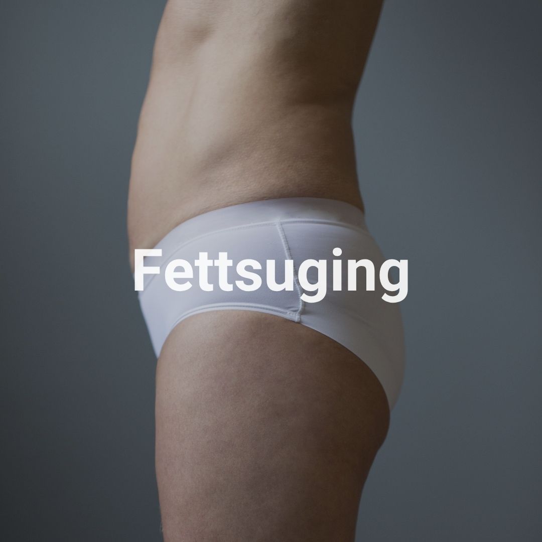 Fettsuging