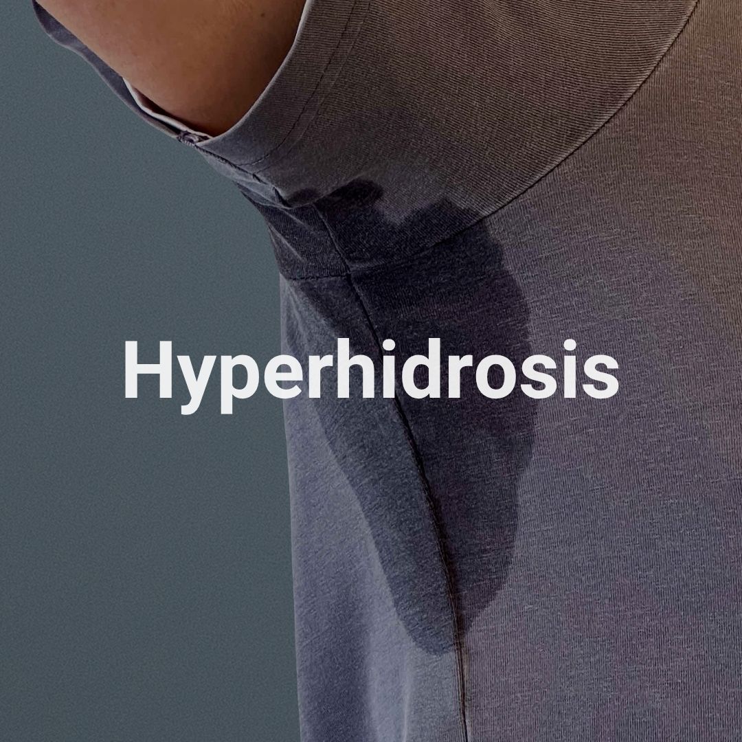 Hyperhidrosis