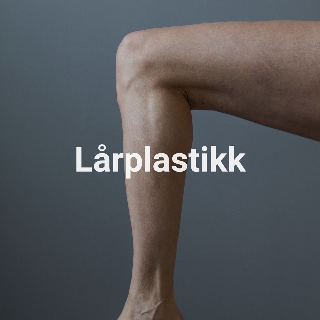 Lårplastikk