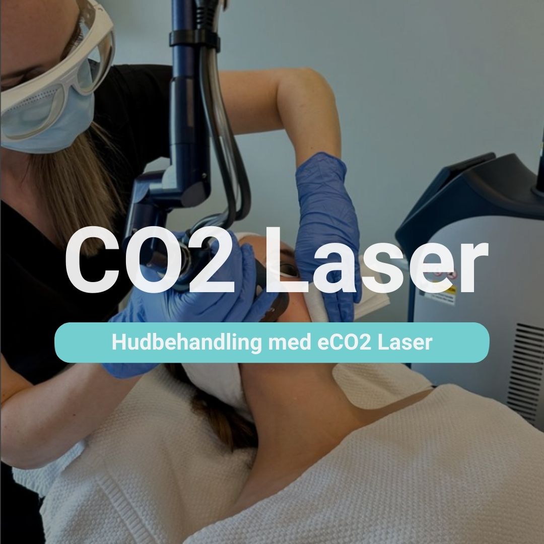 fraksjonert CO2 laser behandling